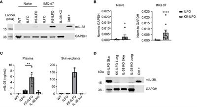 Interleukin-38 overexpression in keratinocytes limits desquamation but does not affect the global severity of imiquimod-induced skin inflammation in mice